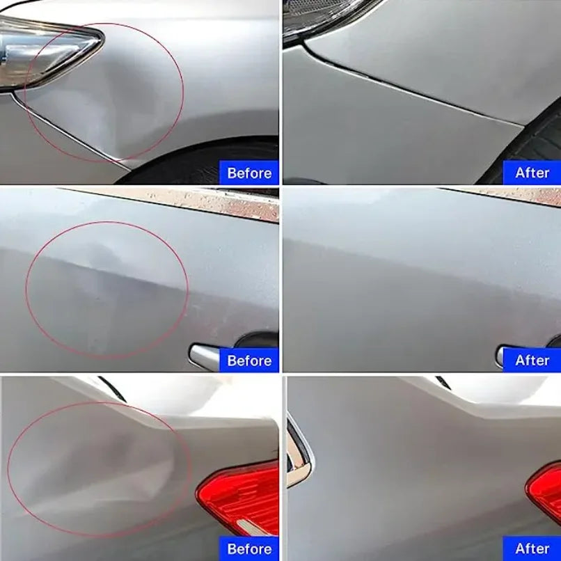 Car Body Sheet Metal Paintless Dent Plastic Puller Kit Auto Hail Pit Removal Repair Tools Hot Multiple Sizes Suction Cup Set CM World
