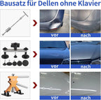 PDR Auto Paintless Body Dent Removal Kits Car Dent Repair Tools Automotive Dent Remover Suction Cup Dent Puller Tool Kit for Car CM World