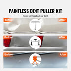 SucceBuy 107PCS Dent Removal Kit Paintless Dent Repair Kit with Lifter Bridge Puller Suction Cup Dent Puller for Auto Body Dents CM World
